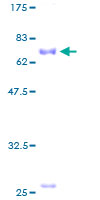 12.5% SDS-PAGE Stained with Coomassie Blue.